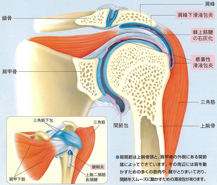 肩関節周囲炎とは