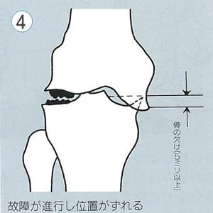 ４．故障が進行し位置がずれる